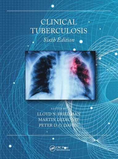 bokomslag Clinical Tuberculosis