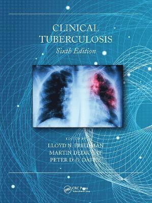 Clinical Tuberculosis