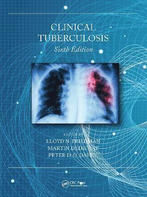 Clinical Tuberculosis 1