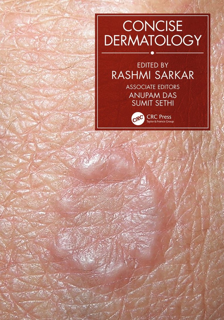 Rashmi Sarkar - Concise Dermatology, Häftad