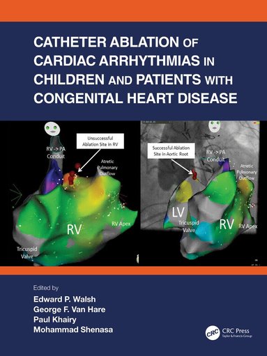 Edward P. Walsh, George F. Van Hare, Paul Khairy, Mohammad Shenasa - Catheter Ablation of Cardiac Arrhythmias in Children and Patients with Congenital Heart Disease, Inbunden