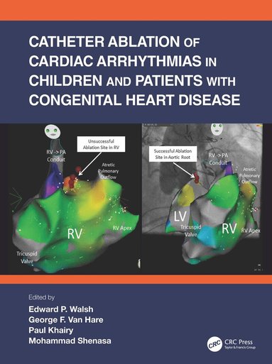 Edward P. Walsh, George F. Van Hare, Paul Khairy, Mohammad Shenasa - Catheter Ablation of Cardiac Arrhythmias in Children and Patients with Congenital Heart Disease, Häftad