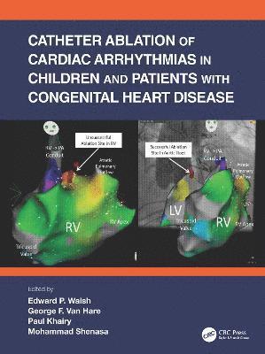 Catheter Ablation of Cardiac Arrhythmias in Children and Patients with Congenital Heart Disease 1