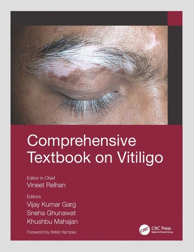 bokomslag Comprehensive Textbook on Vitiligo