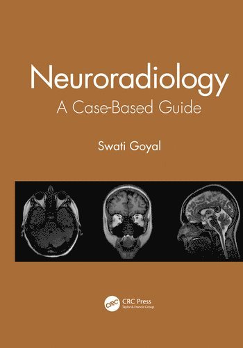 bokomslag Neuroradiology