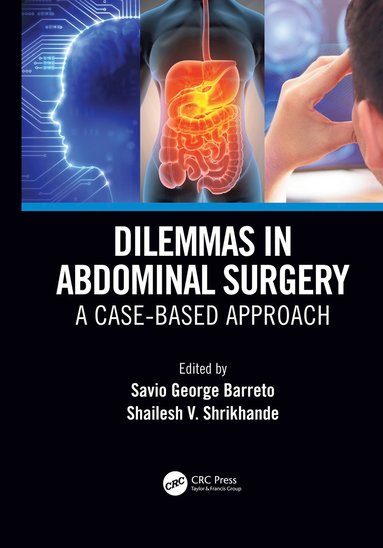 bokomslag Dilemmas in Abdominal Surgery