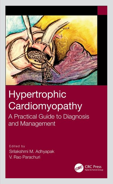 Srilakshmi M. Adhyapak, V. Rao Parachuri - Hypertrophic Cardiomyopathy, Inbunden