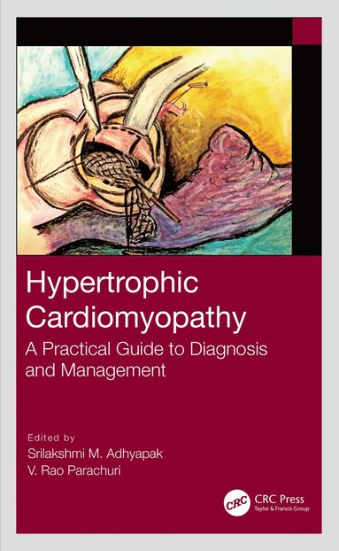 bokomslag Hypertrophic Cardiomyopathy