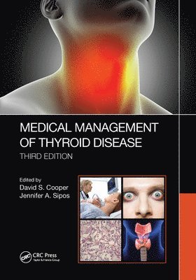 Medical Management of Thyroid Disease, Third Edition 1