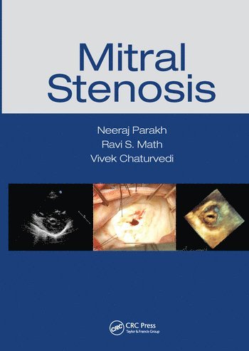 bokomslag Mitral Stenosis