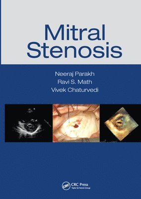 Mitral Stenosis 1