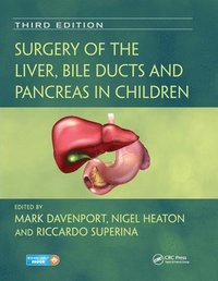 bokomslag Surgery of the Liver, Bile Ducts and Pancreas in Children
