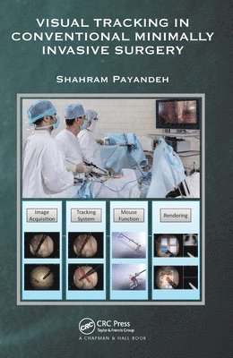 Visual Tracking in Conventional Minimally Invasive Surgery 1