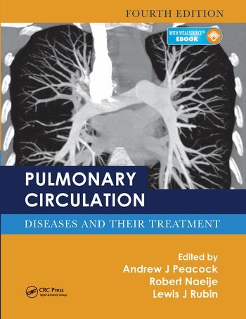 Andrew J. Peacock, Robert Naeije, Lewis J. Rubin - Pulmonary Circulation, Häftad
