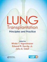 bokomslag Lung Transplantation