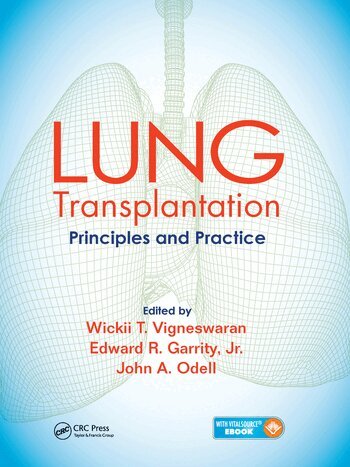 Wickii Vigneswaran, Edward Garrity, John Odell - Lung Transplantation, Häftad