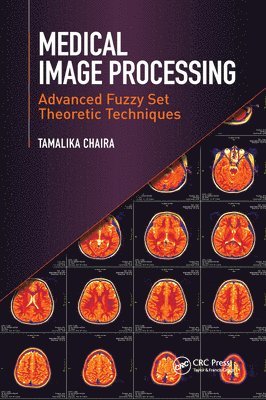 bokomslag Medical Image Processing