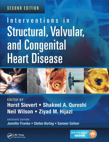 bokomslag Interventions in Structural, Valvular and Congenital Heart Disease