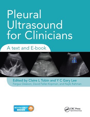 Claire Tobin, Y C Gary Lee, Fergus Gleeson, Najib Rahman, David Feller-Kopman - Pleural Ultrasound for Clinicians, Häftad