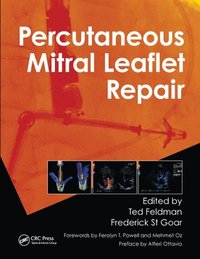 bokomslag Percutaneous Mitral Leaflet Repair