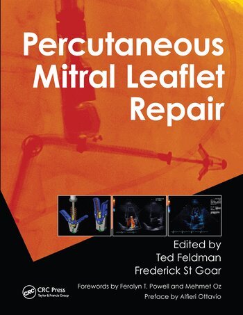 Ted Feldman, Frederick St Goar - Percutaneous Mitral Leaflet Repair, Häftad