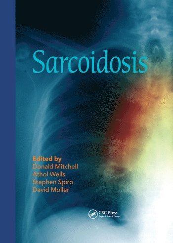 bokomslag Sarcoidosis