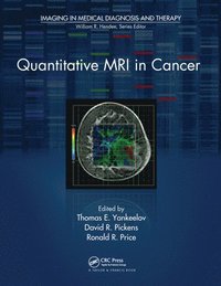 bokomslag Quantitative MRI in Cancer