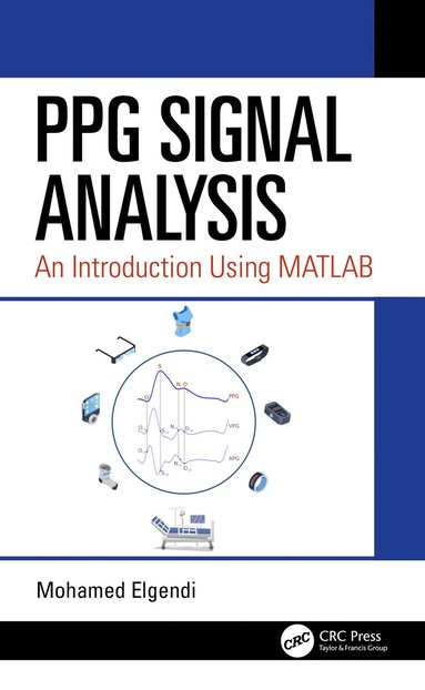 bokomslag PPG Signal Analysis