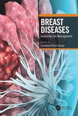 Breast Diseases 1