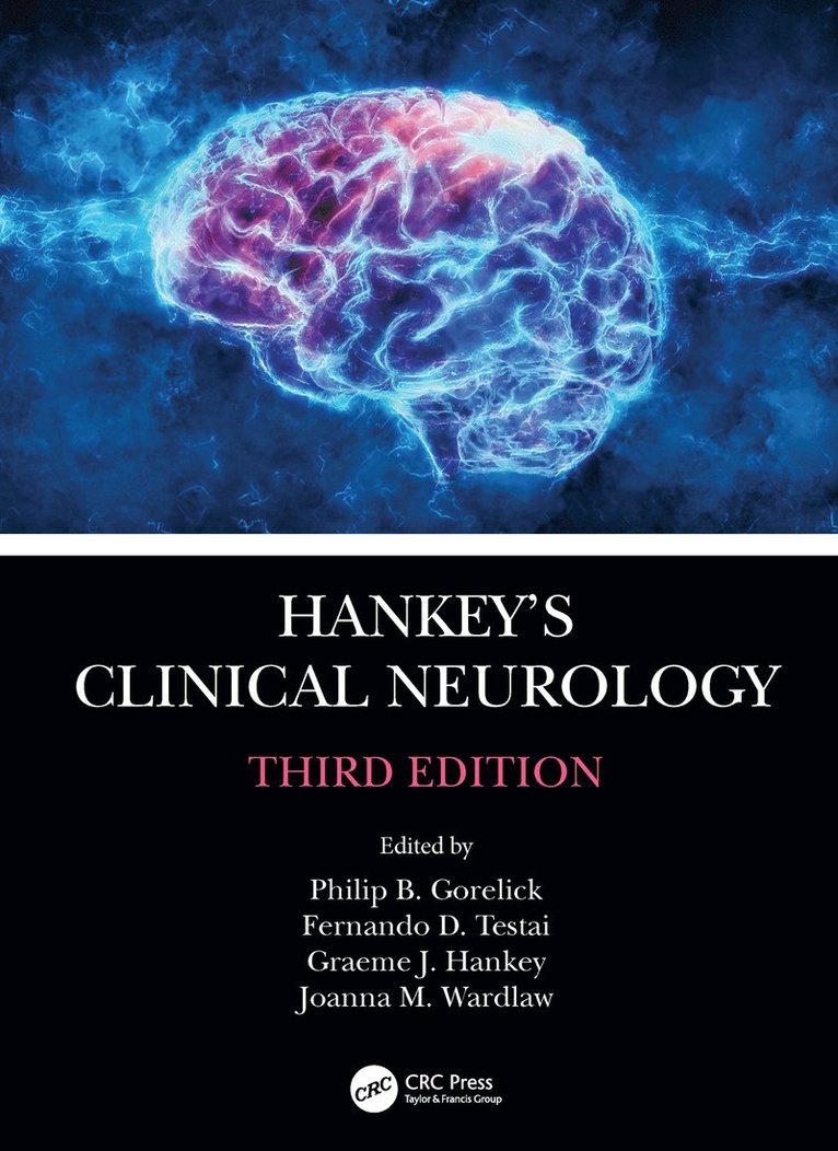 Philip B. Gorelick, Fernando D. Testai, Graeme J. Hankey, Joanna M. Wardlaw, IL) Testai, Fernando D. (Department of Neurology and Rehabilitation, University of Illinois Medical Center, Chicago, Australia) Hankey, Graeme J. (Consultant Neurologist and Head of Stroke Unit, Royal Perth Hospital, Perth, Edinburgh) Wardlaw, Joanna M. (Division of Clinical Neurosciences, The University of Edinburgh, Western General Hospital - Hankey's Clinical Neurology, Inbunden