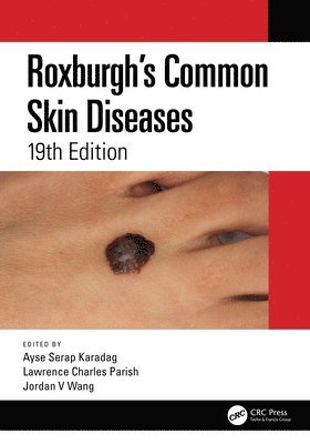 Roxburgh's Common Skin Diseases 1