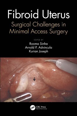 Rooma Sinha, Arnold Advincula, Kurian Joseph, India) Sinha, Rooma (Apollo Hospitals, Hyderabad, USA) Advincula, Arnold (Columbia University Medical Center, New York, India) Joseph, Kurian (Joseph Hospitals, Chennai - Fibroid Uterus, Häftad