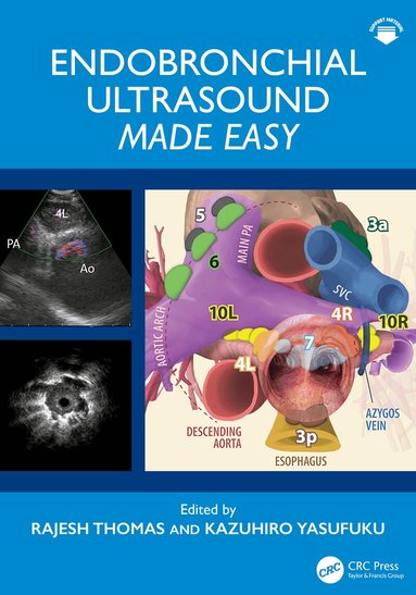 Rajesh Thomas, Kazuhiro Yasufuku - Endobronchial Ultrasound Made Easy, Inbunden