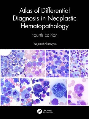 Wojciech Gorczyca - Atlas of Differential Diagnosis in Neoplastic Hematopathology, Inbunden