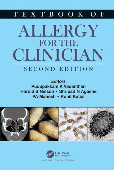 Pudupakkam K. Vedanthan, Harold S. Nelson, Shripad N. Agashe, PA Mahesh, Rohit Katial - Textbook of Allergy for the Clinician, Häftad