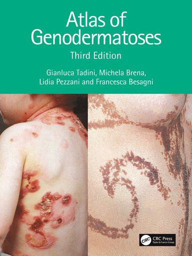 bokomslag Atlas of Genodermatoses