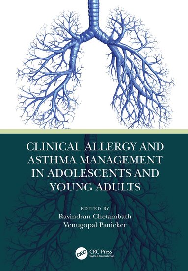 Ravindran Chetambath, Venugopal Panicker - Clinical Allergy and Asthma Management in Adolescents and Young Adults, Inbunden