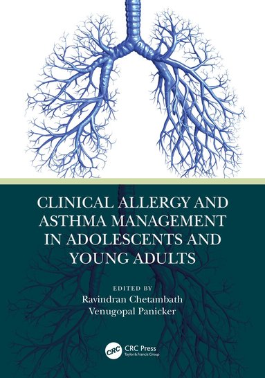 Ravindran Chetambath, Venugopal Panicker - Clinical Allergy and Asthma Management in Adolescents and Young Adults, Häftad