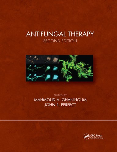 Mahmoud A. Ghannoum, John R. Perfect - Antifungal Therapy, Second Edition, Häftad