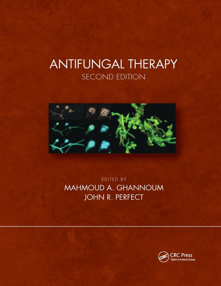 Mahmoud A. Ghannoum, John R. Perfect, USA) Ghannoum, Mahmoud A., PhD, EMBA (University Hospitals Cleveland Medical Center ,Cleveland, OH, USA) Perfect, John R. (Duke University Medical Center, Durham, NC - Antifungal Therapy, Second Edition, Häftad