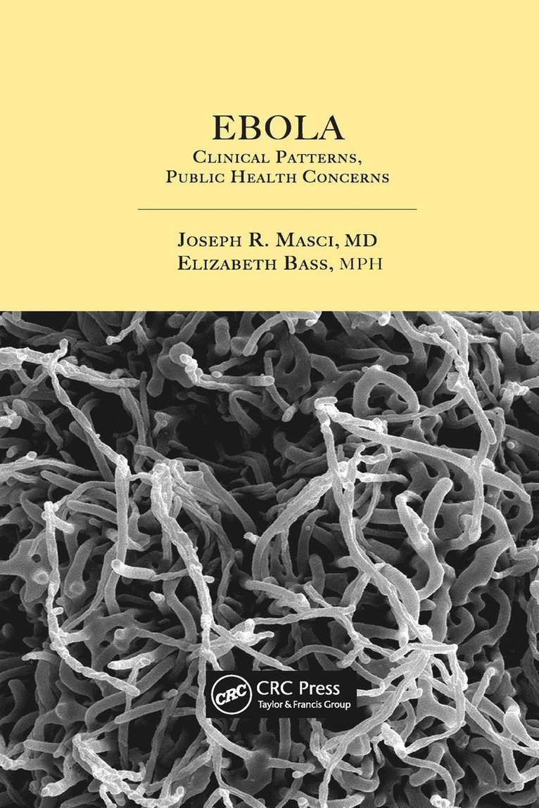 Joseph R. Masci, Elizabeth Bass, USA) Masci, Joseph R., M.D. (Icahn School of Medicine, New York, New York, USA) Bass, Elizabeth (Stony Brook University, New York - Ebola, Häftad