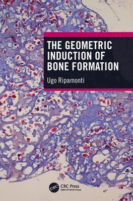 The Geometric Induction of Bone Formation 1
