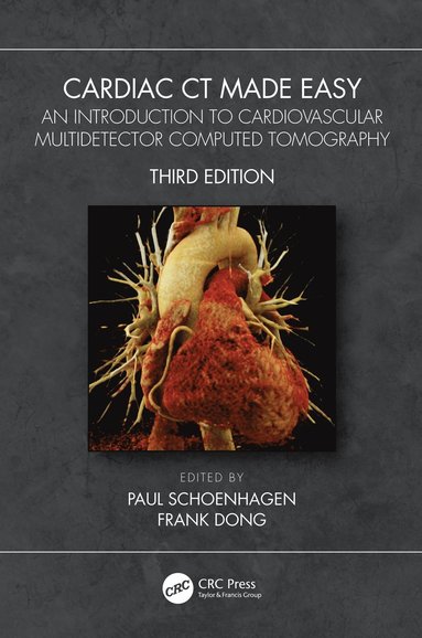 bokomslag Cardiac CT Made Easy