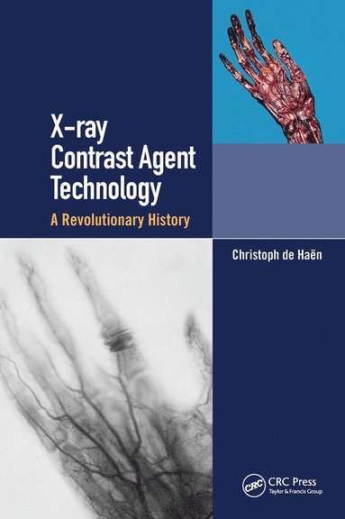 bokomslag X-ray Contrast Agent Technology