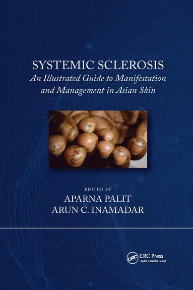 bokomslag Systemic Sclerosis