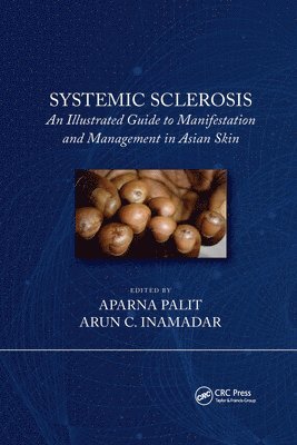 Systemic Sclerosis 1