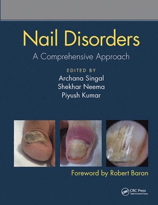 bokomslag Nail Disorders