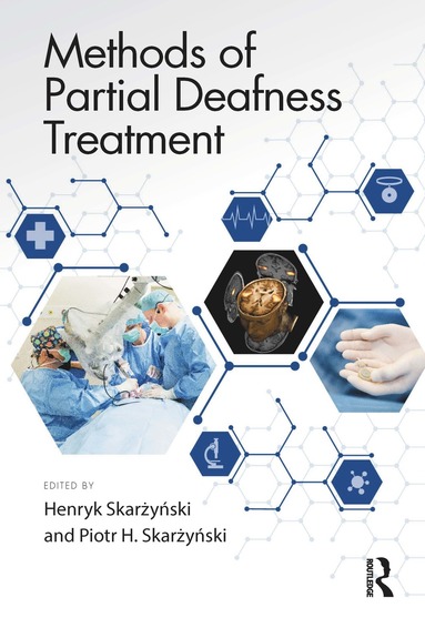 bokomslag Methods of Partial Deafness Treatment