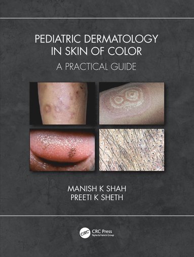 bokomslag Pediatric Dermatology in Skin of Color