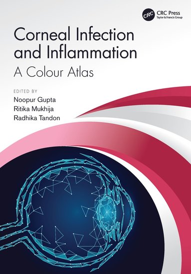 bokomslag Corneal Infection and Inflammation